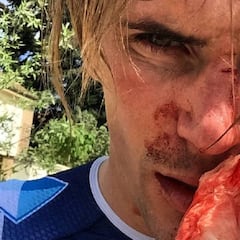 Offredo cuenta los detalles de la salvaje agresión que sufrió