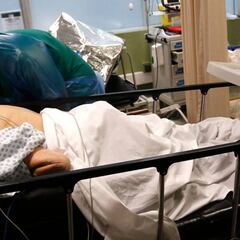 Coronavirus Colombia: ¿cómo afecta el virus a los pacientes con presión alta?