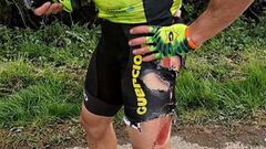 El ciclista Jos&eacute; Carlos N&uacute;&ntilde;ez muestra sus heridas tras ser atropellado en la Rutland-Melton Classic.