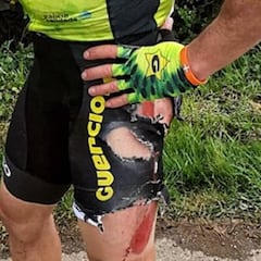 El ciclista español José Carlos Núñez, atropellado en la Rutland-Melton