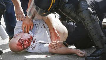 Attempted murder inquiry into England fan beatings at Euro 2016