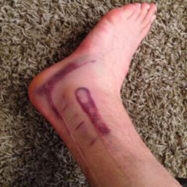 Carroll tiene un esguince en el tobillo y no viaja a Rusia