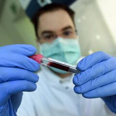 Cómo afecta el coronavirus en función del tipo de sangre