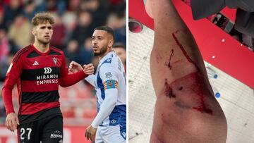 Pablo Ramón, contra el Levante y el estado de su rodilla tras el partido.