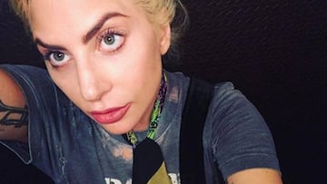 Lady Gaga explica a trav&eacute;s de Twitter que padece fibromialgia.
