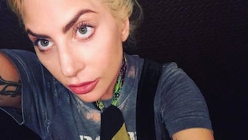 Lady Gaga explica a través de Twitter que padece fibromialgia.