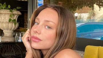 Ester Exp車sito arrasa con una foto al natural: con pecas y sin maquillaje