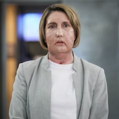 Hito histórico en España: realizado con éxito el primer trasplante de cara del mundo