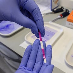 ¿Cuánto duran en la sangre los anticuerpos contra el coronavirus?