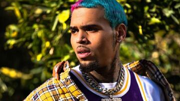 Una empleada de Chris Brown le denuncia tras sufrir el brutal ataque de su perro