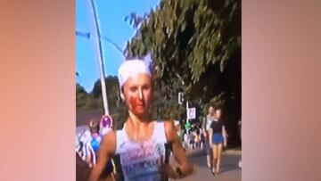 Una de las imágenes de los europeos: corre con la cara totalmente ensangrentada