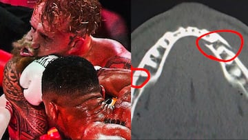 Así quedó la mandíbula de Jake Paul tras pelea con Anthony Joshua