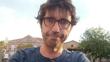 ‘Lichis’, exlíder de ‘La Cabra Mecánica’, ingresado por un problema cardíaco