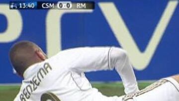 Benzema se retiró lesionado tras un disparo fallido