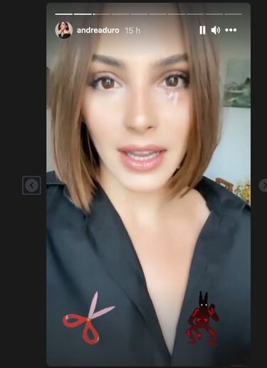 Andrea Duro relata el accidente domstico que casi pone en peligro su ojo
