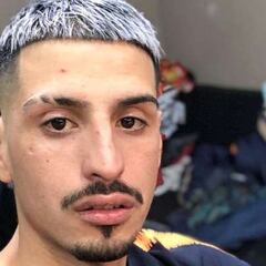 Murió El Noba: el músico estuvo 10 días en terapia intensiva