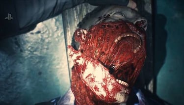 ¿Por qué Resident Evil 2 Remake resulta «asquerosamente aterrador»?