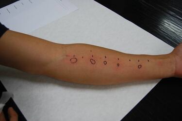 10 cosas que demuestran que los alérgicos tienen superpoderes