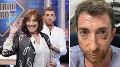 Im&aacute;genes de Pablo Motos con la actriz Carmen Maura en &quot;El Hormiguero&quot; y del presentador con la cara amoratada tras una sesi&oacute;n de boxeo.