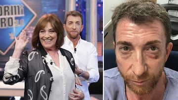 Imágenes de Pablo Motos con la actriz Carmen Maura en "El Hormiguero" y del presentador con la cara amoratada tras una sesión de boxeo.