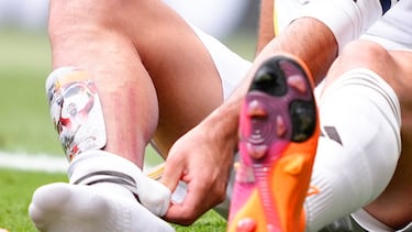 Una de las mayores polémicas del derbi ocurrió en el minuto cuarenta de la primera parte cuando el jugador argentino del Atlético de Madrid llegó tarde a un balón dividido con el lateral derecho del Real Madrid. La dura acción fue castigada con una tarjeta amarilla para el jugador rojiblanco. Jugadores del Real Madrid pidieron la expulsión de Nico. El VAR no avisó a Alberola Rojas.