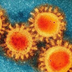 Coronavirus Perú: características y cómo se transmite