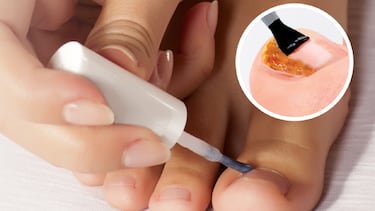 ¿Cómo curar los hongos en las uñas? Este es el mejor tratamiento