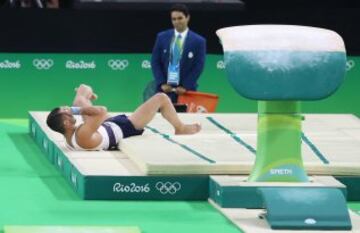 El gimnasta francés Samir Ait Said sufrió la lesión más espeluznante de los Juegos de Río. Se fracturó la tibia y el peroné de su pierna izquierda en la salida de su ejercicio de salto del potro.