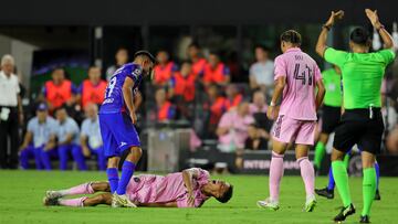 Messi's Inter Miami teammate Ian Fray, to whom the Argentine sent a message at the end of the game, will miss the rest of the season.