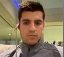 La curiosa habilidad de Morata con una cuchara y su oreja que muy pocos son capaces de hacer