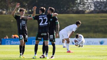 El Castilla mejora, pero pierde