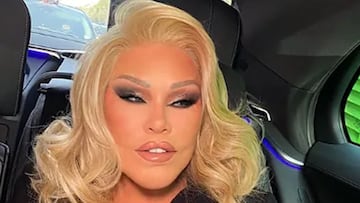 La famosa ‘mujer gato’ deja una herencia inesperada de casi 94 millones de euros, pero dos de sus hijos no verán ni un duro