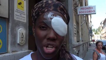 Daisy Osakue, herida con huevos en un posible ataque racista