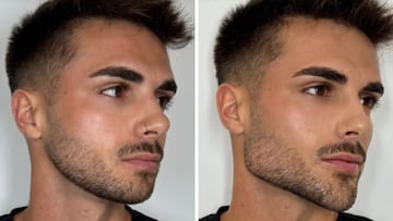 El cambio físico de Joel tras su paso por ‘La isla de las tentaciones’: “Ha acabado con el ácido hialurónico de España”