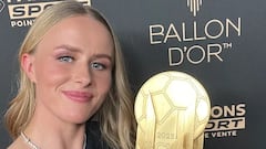 “Tengo un ojo vago y leo burlas por mis fotos”