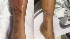 Rojas muestra su mejoría tras su dura caída en la Vuelta