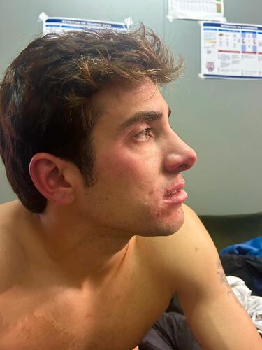 Chile se indigna por la derrota en Copa Davis y así reaccionan: recetas para Bergs