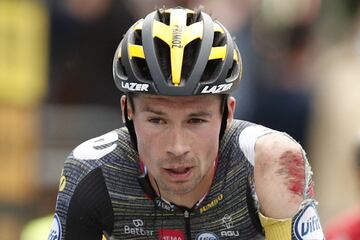El ciclista esloveno Primoz Roglic con una herida en el hombro tras una caída. 