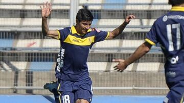 Ex jugador de Barnechea subasta histórica camiseta para ayudar a su hermano