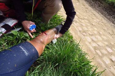 Grave lesi¨®n de Jorgenson en Roubaix por un freno de disco