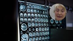 Mercè Boada, neuróloga: “La vejez está en la mente, no en la edad cronológica”