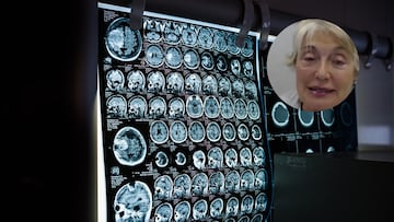 Mercè Boada, neuróloga: “La vejez está en la mente, no en la edad cronológica”