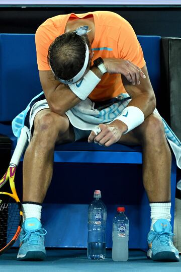 Rafa Nadal ha perdido en el Abierto de Australia contra el estadounidense McDonald tras sentir dolores en su cadera que no le han dejado continuar con normalidad.