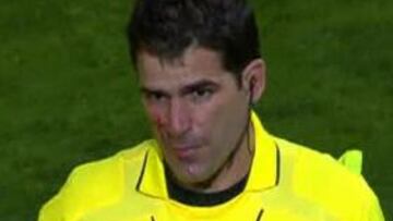 El asistente sufre "un pequeño arañazo" en la cara