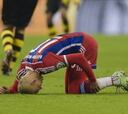 Robben es baja; Lewandowski, "fractura de mandíbula y nariz"