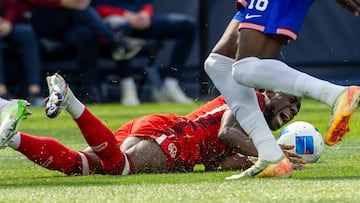 ¡Davies se rompe el cruzado!