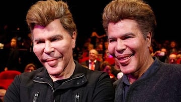 Los gemelos más famosos de Francia mueren por COVID-19