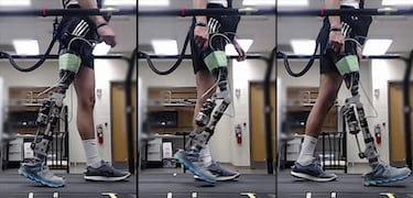 La rodilla robótica que permite volver a andar en 10 minutos a personas con discapacidad