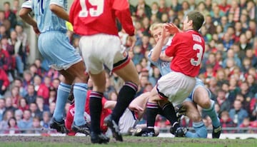 La de David Busst es una de esas lesiones que, aquellos que la vieron, no podrán olvidar jamás. El jugador del Coventry City sufrió en la temporada 1995-1996 múltiples fracturas de tibia y peroné en un desafortunado incidente con Denis Irwin, jugador del Manchester United. Tuvo que ser operado 10 veces en 12 días y tuvo una grave infección por estafilococos. Le retiraron del fútbol las infecciones, ya que tuvo que pasar por el quirófano un total de 26 veces.