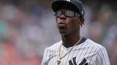 Why does Yankees’ infielder Jazz Chisholm require surgery?